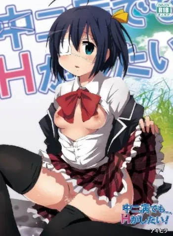 [Studio Nunchaku (Akihira)] Chuunibyou demo Ecchi ga Shitai! (Chuunibyou Demo Koi ga Shitai!) [Digital] manga cover